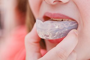 Woman With Mouthguard