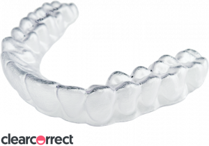 Clear Correct Aligners