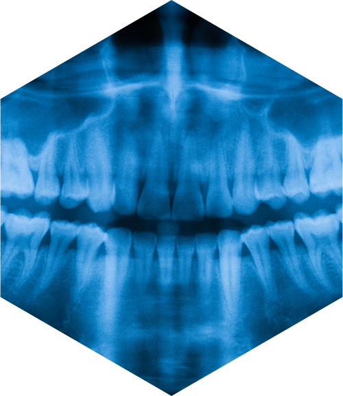 Digital X-Rays