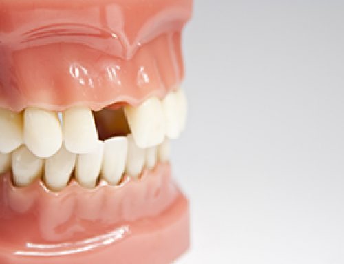 Uh-oh! A Dental Emergency