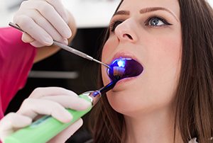 Woman Getting a Cavity Filled