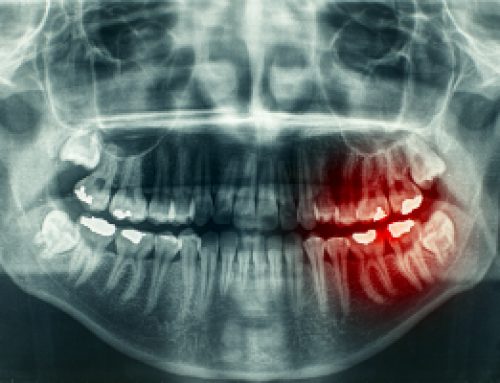 Dental X-Rays: Get the Real Picture!