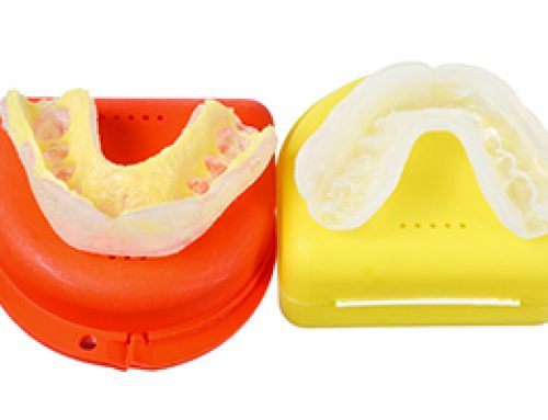 Athletic Mouthguards