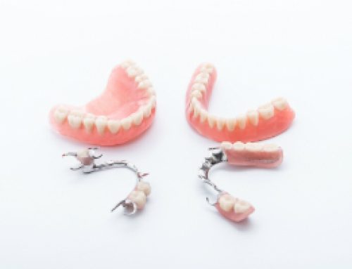 Dentures: Are They For You?