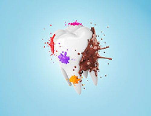 Tooth Stains: What Foods Cause Them?