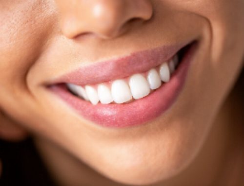 Get a Cosmetic Dentistry Consultation