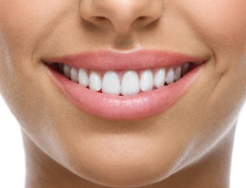 Smile Makeover in West Lake Hills, TX