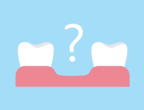 Missing Teeth? Know Your Options