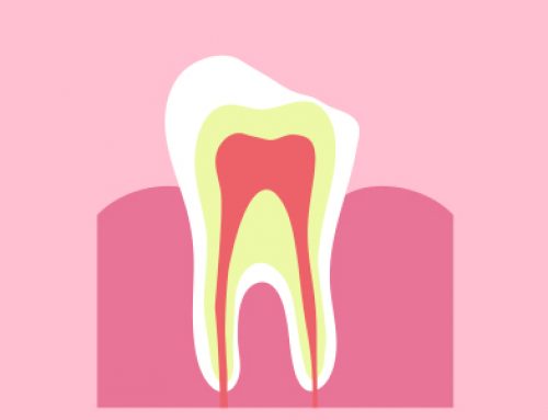 Do You Have A Chipped Tooth?