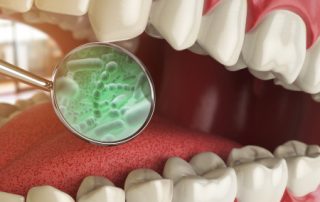 Bacteria And Microbes Around Tooth