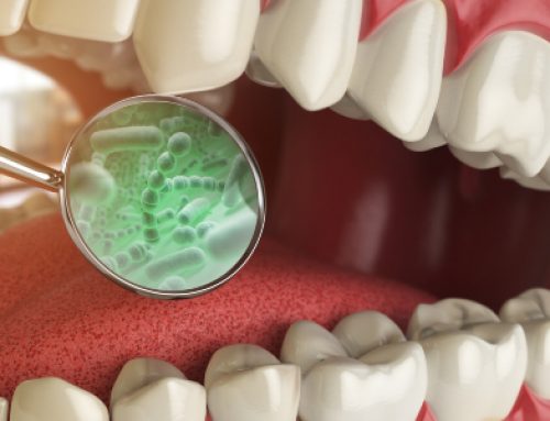 Bacteria That Cause Cavities