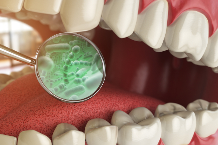 Bacteria And Microbes Around Tooth